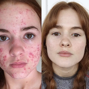 2019 year - Yet Another Reason To Avoid Tanning Beds 2019 year