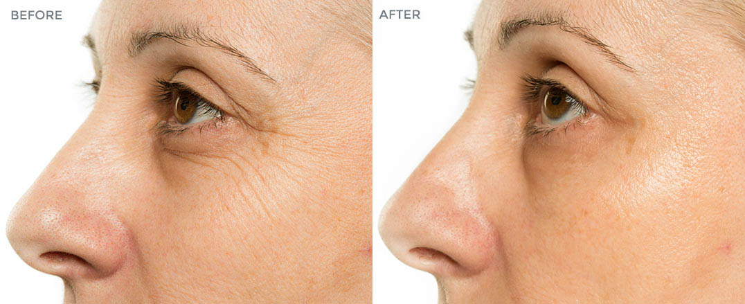 The Miracle Cream Everyone Is Raving About Makes Skin Look Years Younger in Just ONE Hour