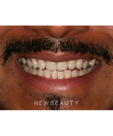dr-laurence-rifkin-smile-makeover-b