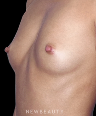 dr-sean-simon-enhancing-volume-b