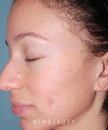 dr-sean-simon-fresh-and-clear-skin-b