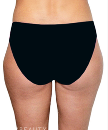 dr-david-rapaport-liposuction-b