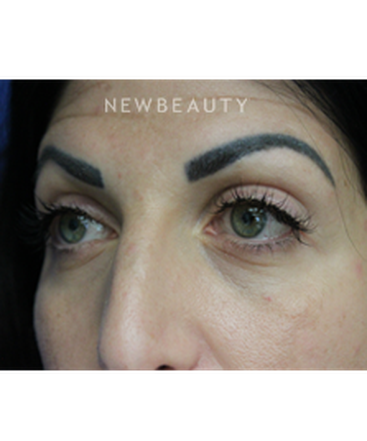 dr-joseph-russo-a-fresh-look-eye-ebg-b