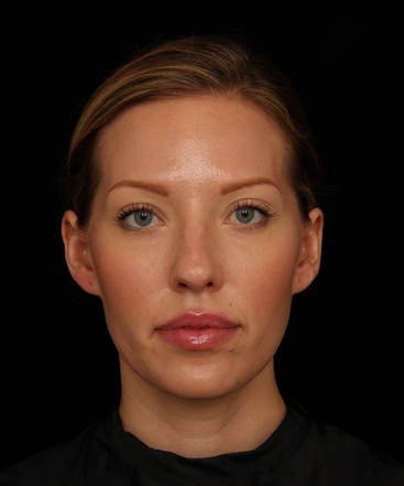 dr-jennifer-m-segal-brighter-appearance-b