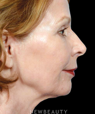 dr-bryan-w-gawley-refreshed-and-rejuvenated-b