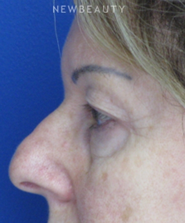 dr-joseph-russo-refreshed-and-restored-eye-ebg-b