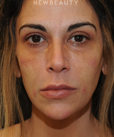 dr-janet-allenby-liquid-rejuvenation-b