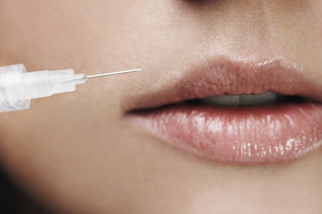 This New Hyaluronic Acid Filler Promises Next to No Swelling
