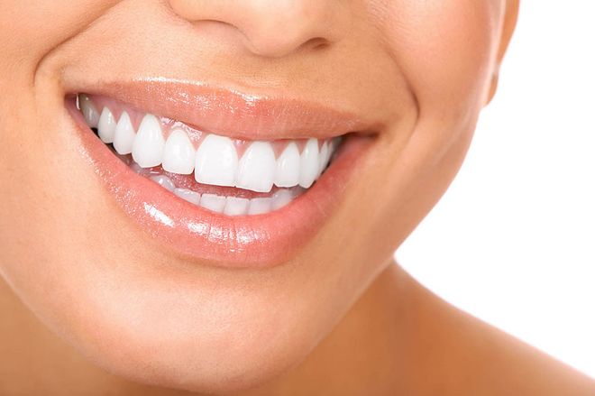 Make a gummy smile look gorgeous