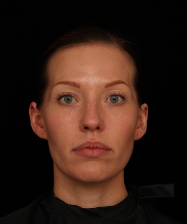 dr-jennifer-m-segal-brighter-appearance-b