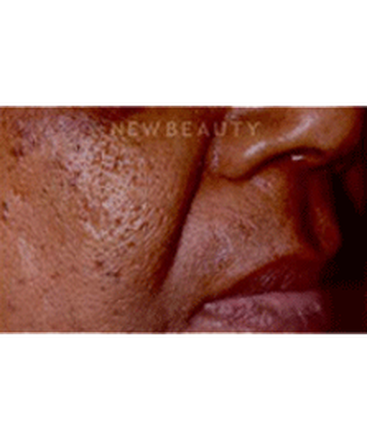 dr-charles-crutchfield-aesthetic-injectables-b