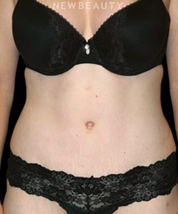 dr-bryan-w-gawley-a-new-waistline-b