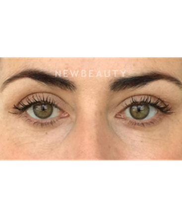 dr-raymond-douglas-eye-enhancement-b