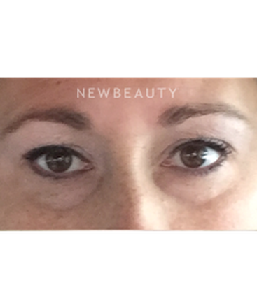 dr-janet-allenby-kybella-b