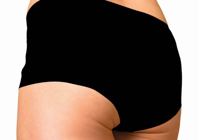 Why Cellulite Happens