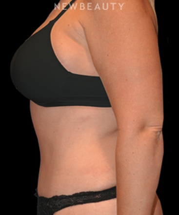 dr-bryan-w-gawley-a-slender-shape-b