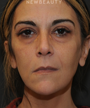 dr-janet-allenby-liquid-rejuvenation-b