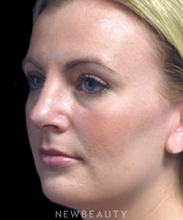 dr-jeffrey-b-wise-natural-looking-enhancement-b