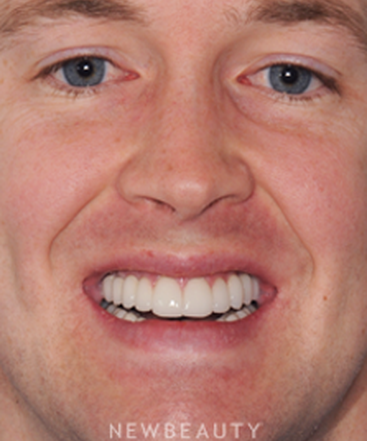 dr-ronald-goldstein-smile-makeover-b