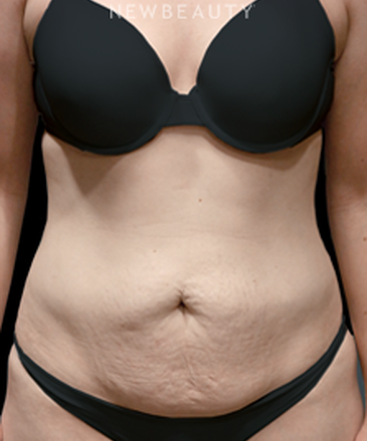 dr-bryan-w-gawley-a-new-waistline-b