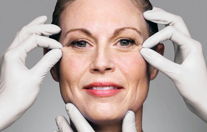 Comparing Facelifts