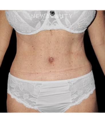 dr-bryan-w-gawley-fit-and-trim-results-b