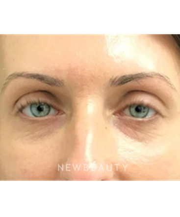 dr-janet-allenby-injectables-fillers-b