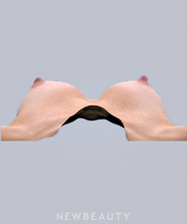 dr-bradley-bengtson-vectra-3d-imaging-b