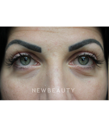 dr-joseph-russo-youthful-look-eye-ebg-b