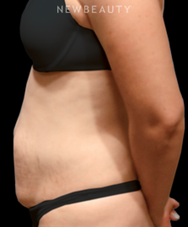 dr-bryan-w-gawley-sculpted-silhouette-b