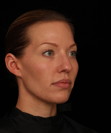 dr-jennifer-m-segal-brighter-appearance-b