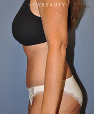 dr-bryan-w-gawley-slimming-profile-b