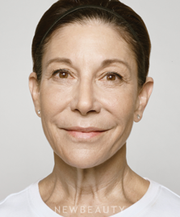 dr-ava-shamban-facial-rejuvenation-b