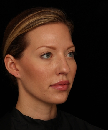 dr-jennifer-m-segal-brighter-appearance-b