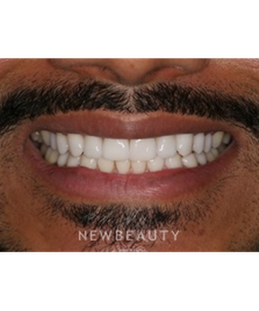 dr-laurence-rifkin-smile-makeover-b