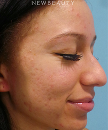 dr-sean-simon-fresh-and-clear-skin-b