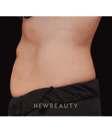 dr-janet-allenby-fat-melters-b