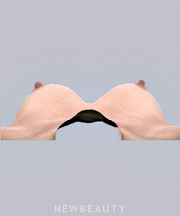dr-bradley-bengtson-vectra-3d-imaging-b