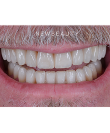 goldstein-garber-salama-smile-makeover-b