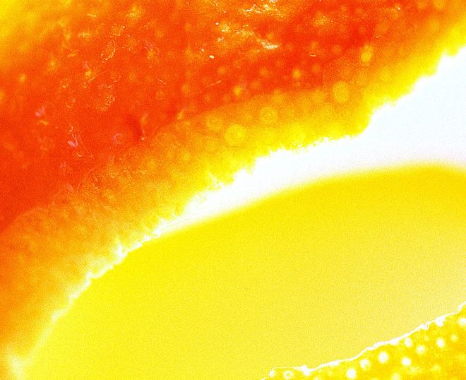 The Different Types of Cellulite