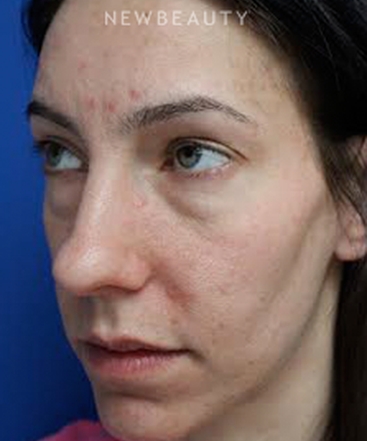 dr-joseph-russo-beautiful-results-eye-ebg-b