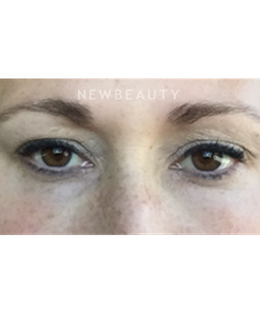 dr-janet-allenby-kybella-b