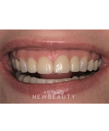 drs-goldstein-salama-a-megawatt-smile-b