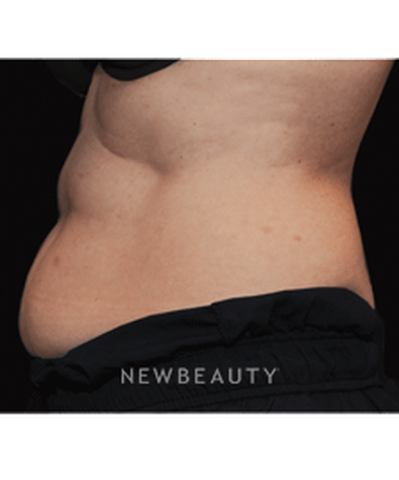 dr-janet-allenby-fat-melters-b