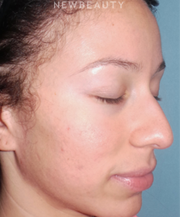dr-sean-simon-fresh-and-clear-skin-b