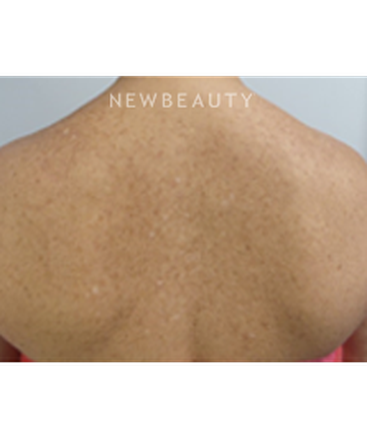 dr-marina-peredo-and-more-skinfluence-trinity-treatment-b