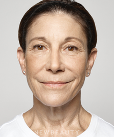 dr-ava-shamban-facial-rejuvenation-b