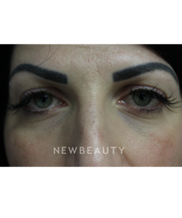 dr-joseph-russo-youthful-look-eye-ebg-b