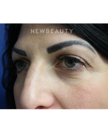 dr-joseph-russo-a-fresh-look-eye-ebg-b