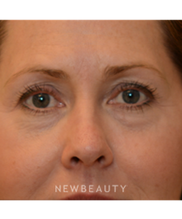dr-janet-allenby-kybella-b